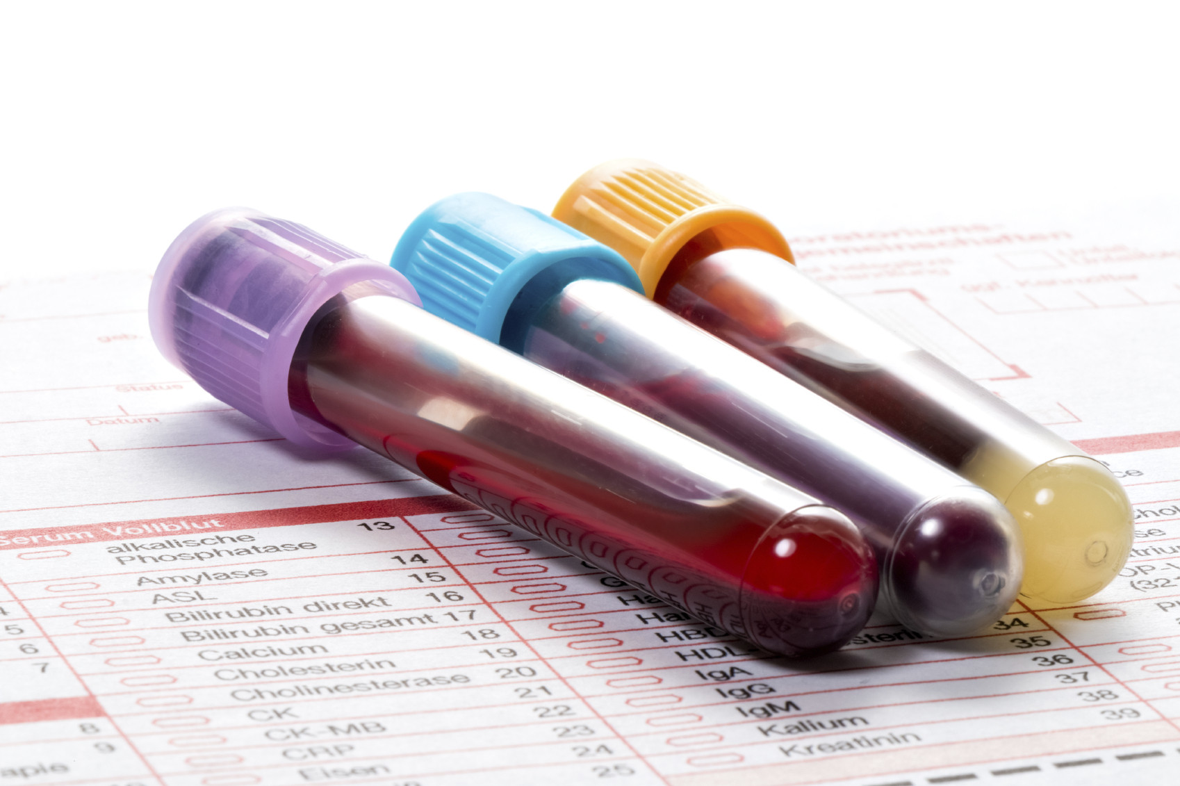 Where to do a general blood test in Batumi